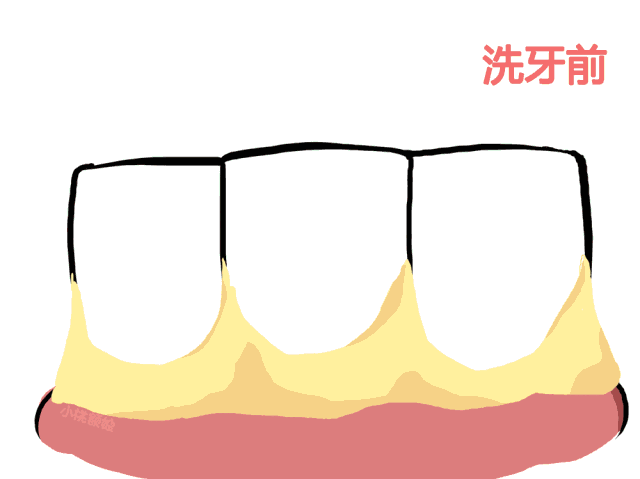 【两店通用 | 贝杰口腔】29.9元享门市价353元套餐,一次性口腔器械+超声波洁牙+抛光膏全口抛光...关爱牙齿,关爱健康~